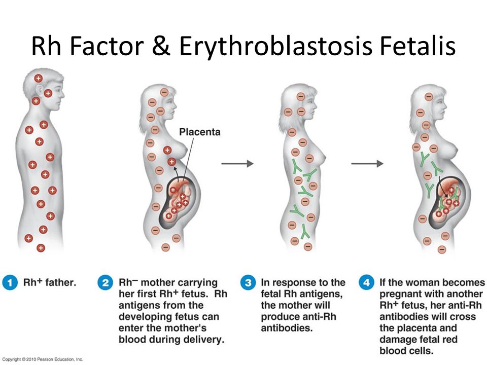 Rh Factor & Erythroblastosis Fetalis