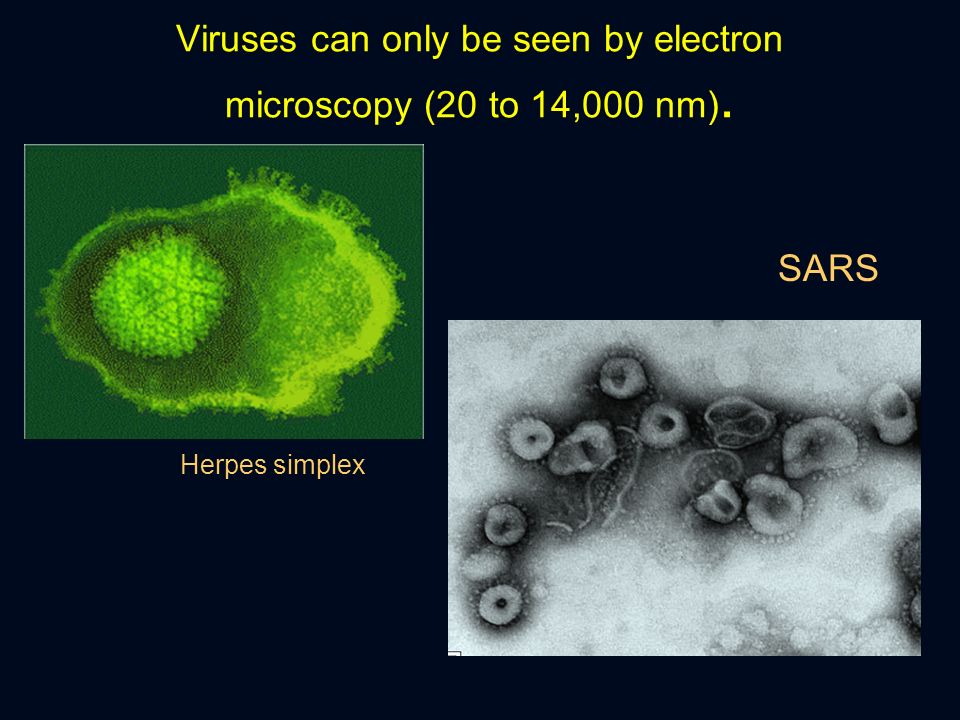 Viruses can only be seen by electron microscopy (20 to 14,000 nm). Herpes simplex SARS