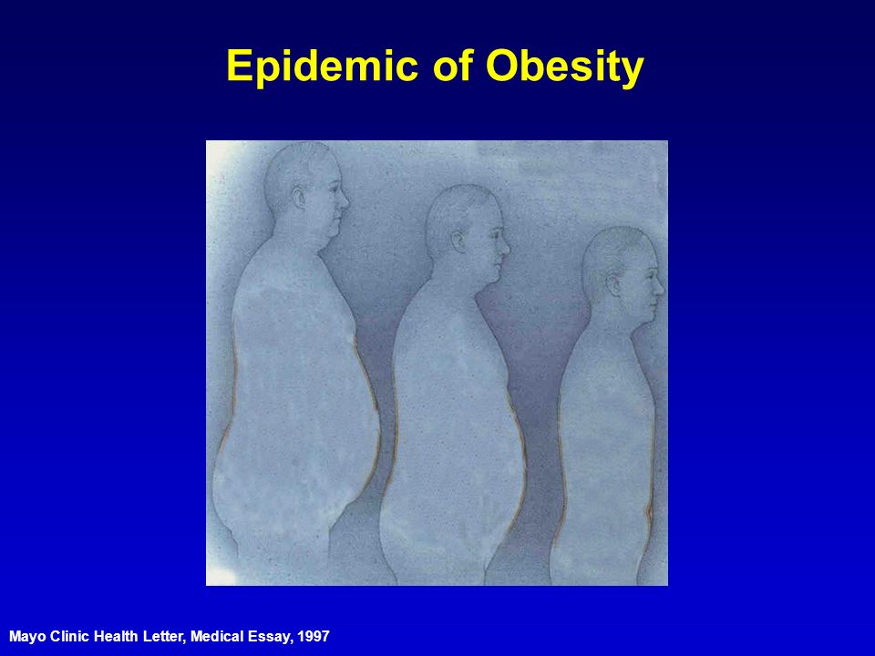 Epidemic of Obesity Mayo Clinic Health Letter Medical Essay ppt Epidemic of Obesity Mayo Clinic Health Letter Medical Essay ppt