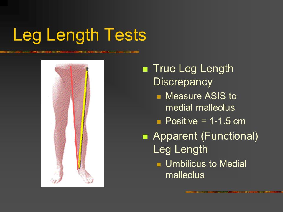 Hip Special Tests. Hip Scouring Test p?video_id=159603&title=Hip_Scouring_T  est&vpkey= - ppt download
