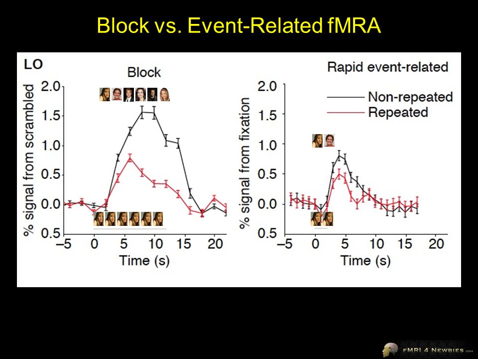 Block vs. Event-Related fMRA