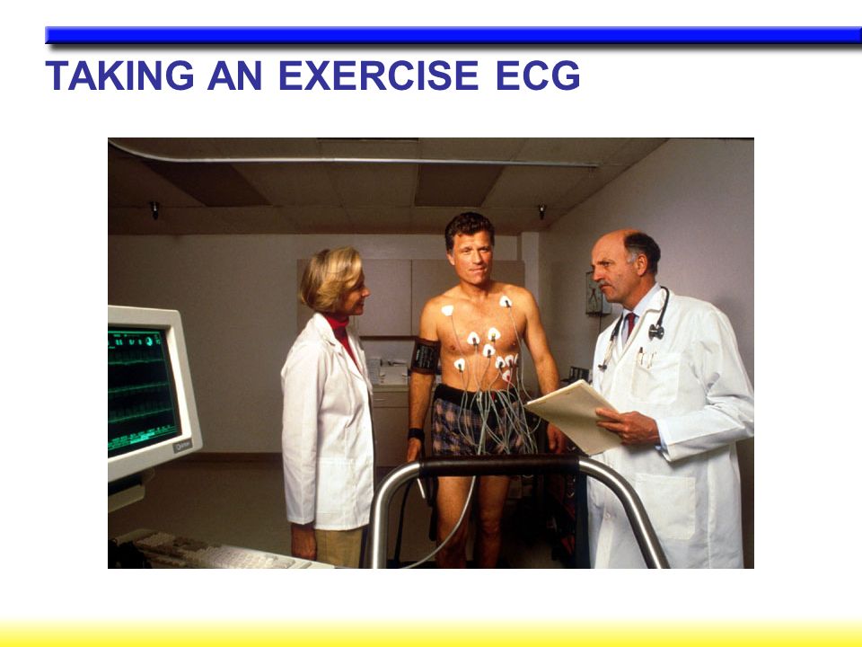 TAKING AN EXERCISE ECG