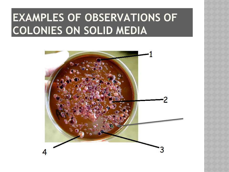 EXAMPLES OF OBSERVATIONS OF COLONIES ON SOLID MEDIA