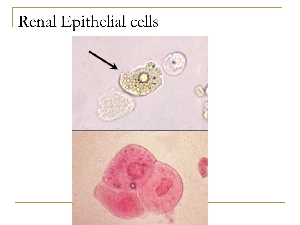 Renal Epithelial cells