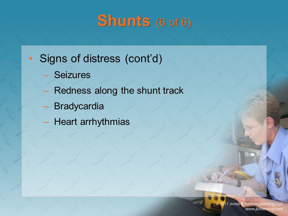 Shunts (6 of 6) Signs of distress (cont’d) –Seizures –Redness along the shunt track –Bradycardia –Heart arrhythmias