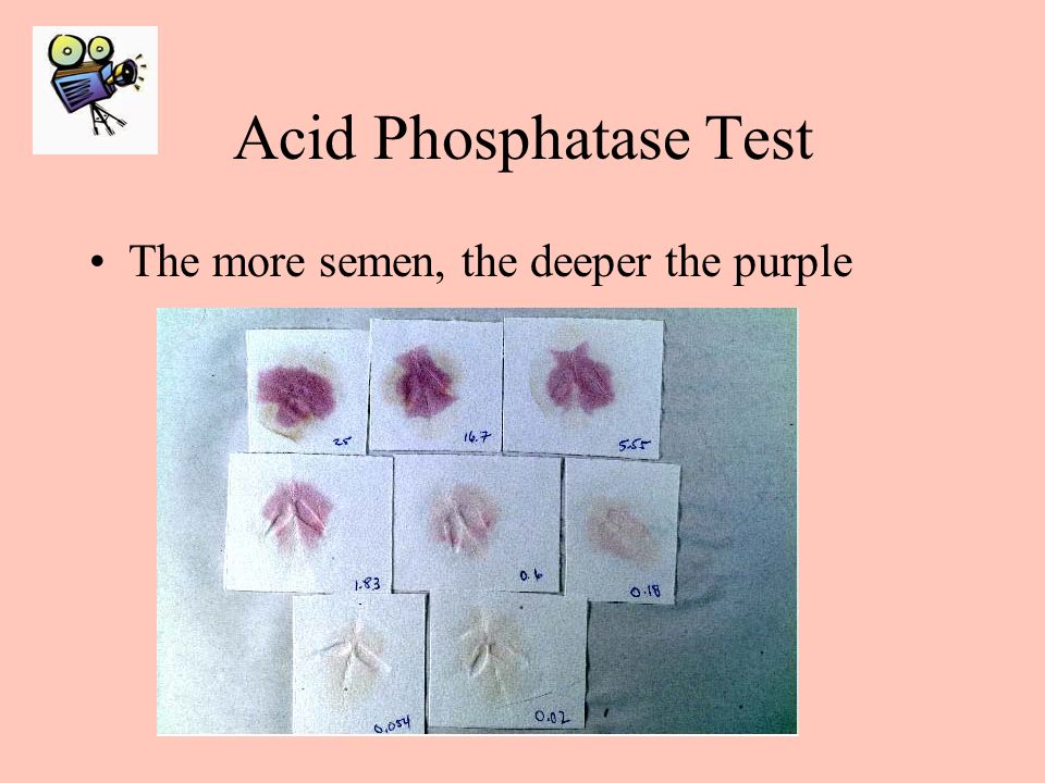 acid phosphatase test forensics