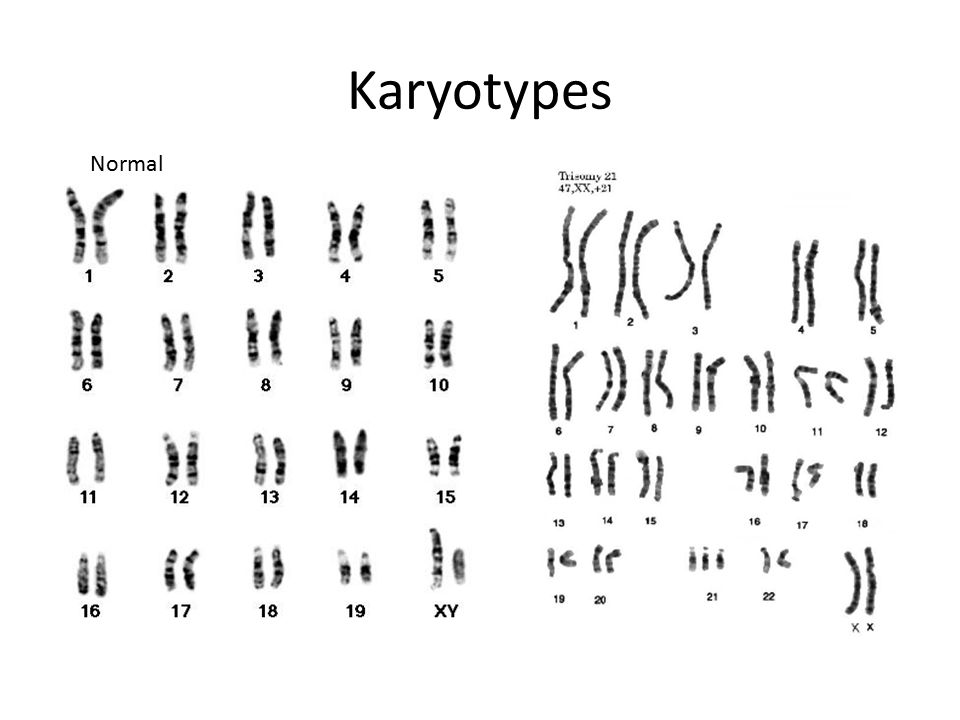 14 1 Human Chromosomes Key Questions 1 What Is A Karyotype 2 What Patterns Of Inheritance Do Human Traits Follow 3 How Can Pedigrees Be Used To Analyze Ppt Download