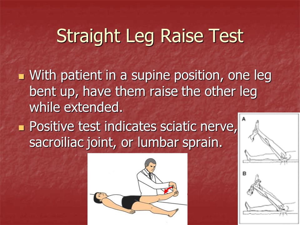 Leg Raise Test - Supine Position - Trial Exhibits Inc.