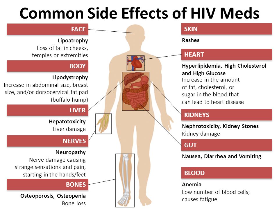 Common Side Effects of HIV Meds Lipoatrophy Loss of fat in cheeks