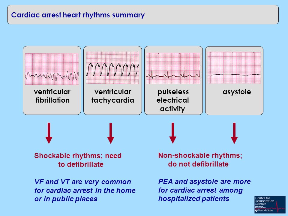 Early Cpr Matters What About Early Defibrillation First Important To Understand Different Cardiac Arrest Rhythms Ventricular Fibrillation Heart Rhythm Ppt Download