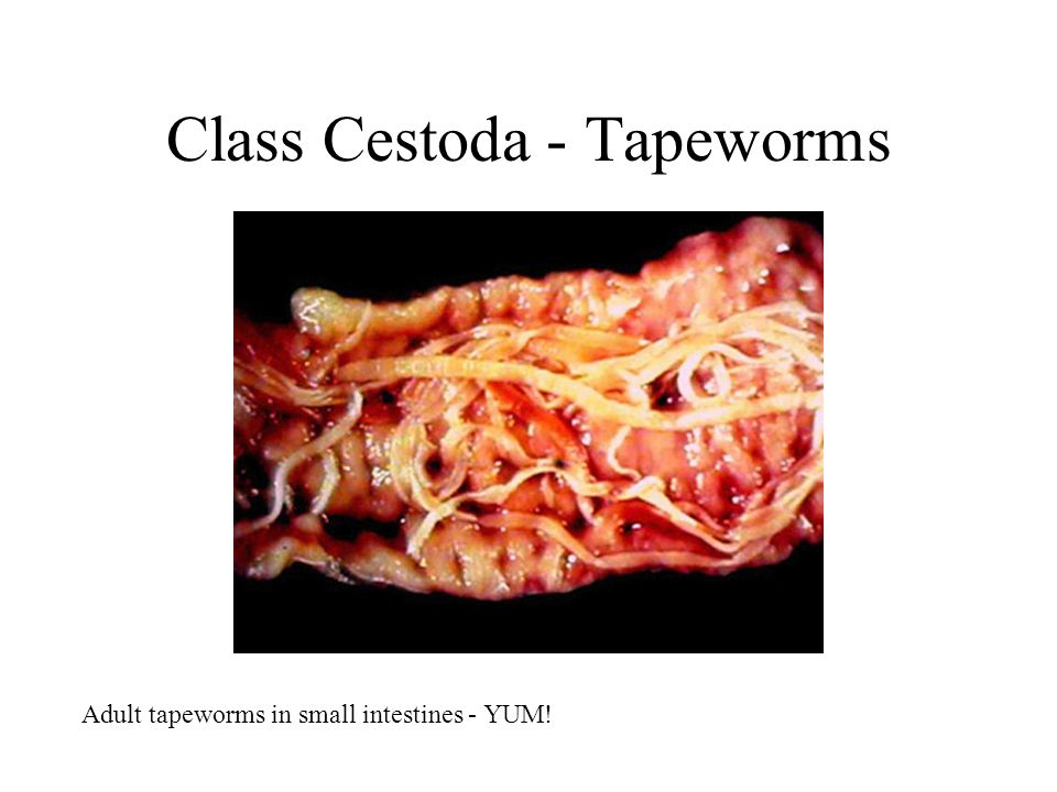 Class Cestoda - Tapeworms Adult tapeworms in small intestines - YUM!