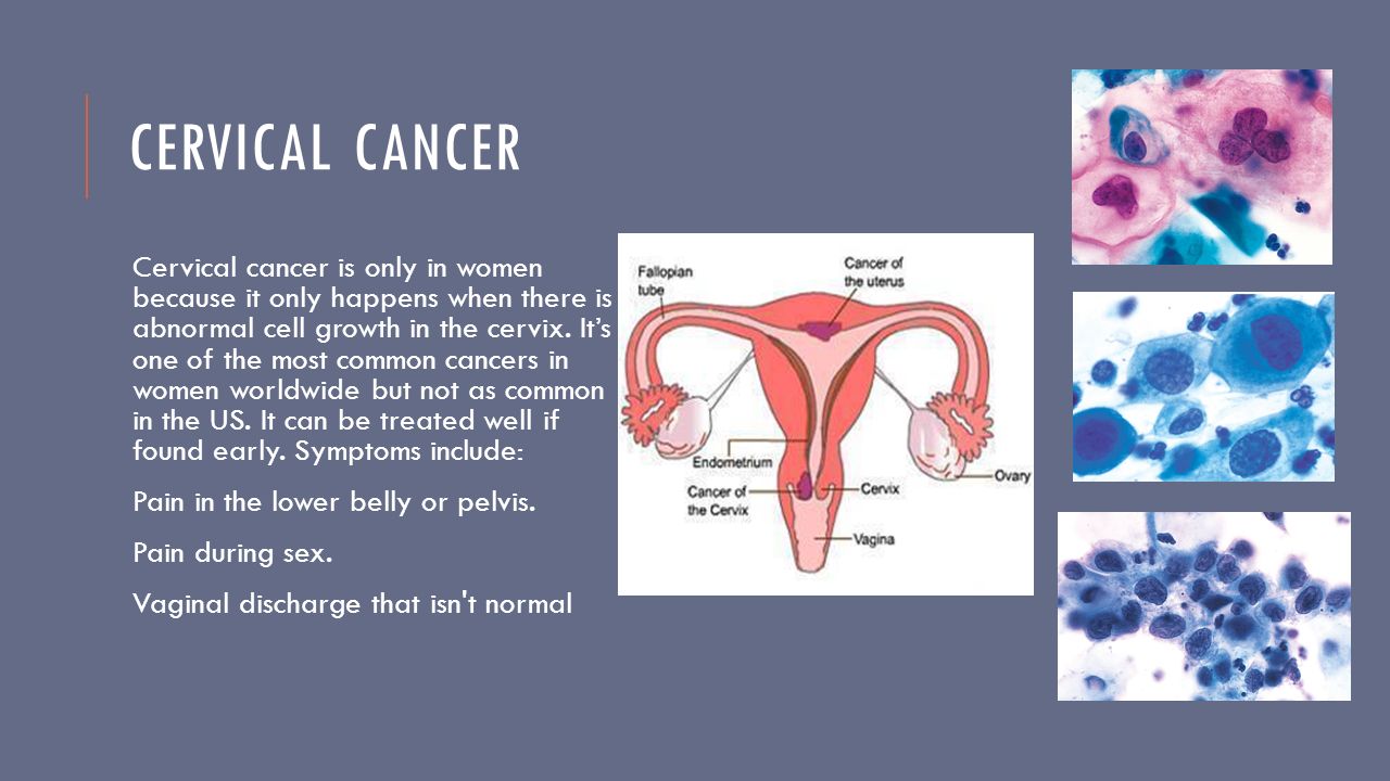 Staging and grading of vaginal cancer