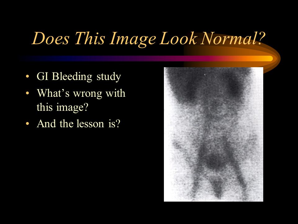 Does This Image Look Normal GI Bleeding study What’s wrong with this image And the lesson is