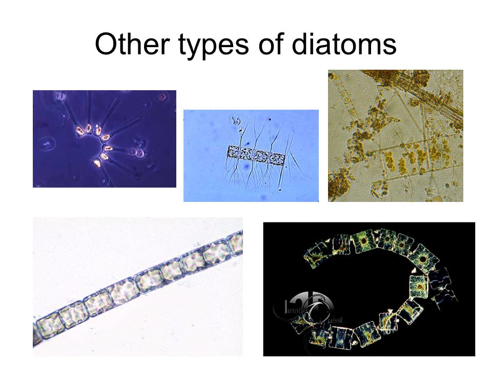 Other types of diatoms