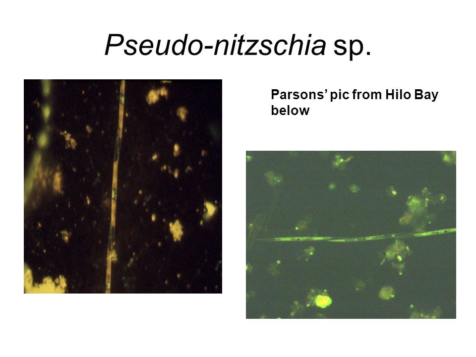 Pseudo-nitzschia sp. Parsons’ pic from Hilo Bay below