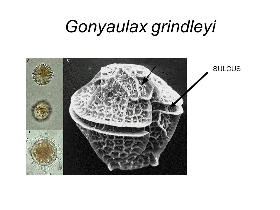 Gonyaulax grindleyi SULCUS