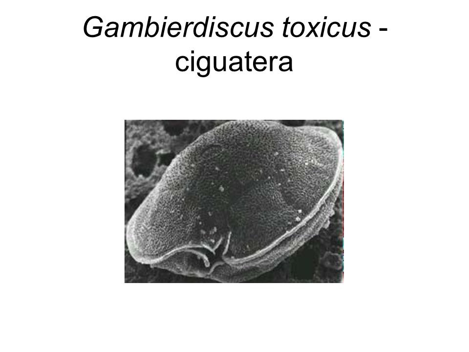 Gambierdiscus toxicus - ciguatera