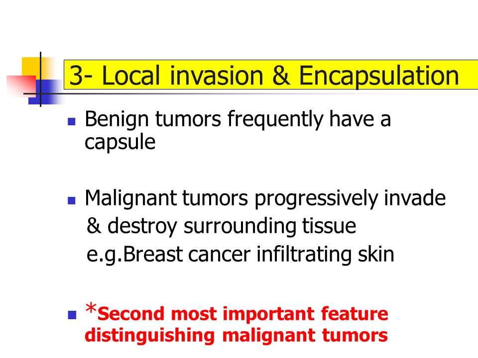 Benign tumors frequently have a capsule Malignant tumors progressively invade & destroy surrounding tissue e.g.Breast cancer infiltrating skin * Second most important feature distinguishing malignant tumors 3- Local invasion & Encapsulation