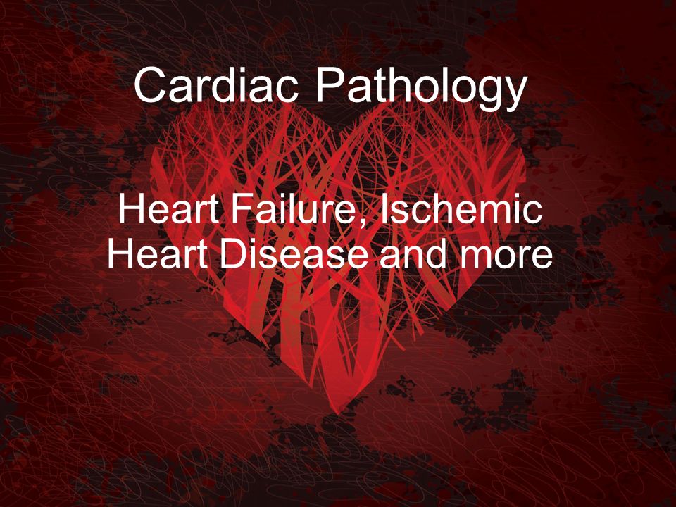 Cardiac Pathology Heart Failure, Ischemic Heart Disease and more