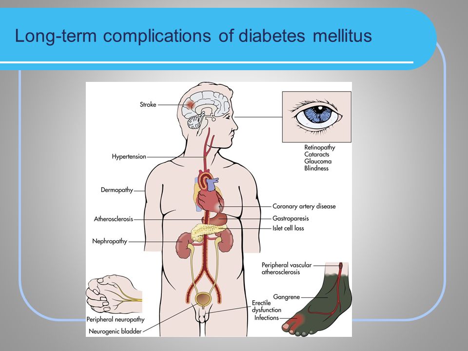 Long-Term Complications of Diabetes Mellitus Marion Technical College NUR  1020 Spring ppt download