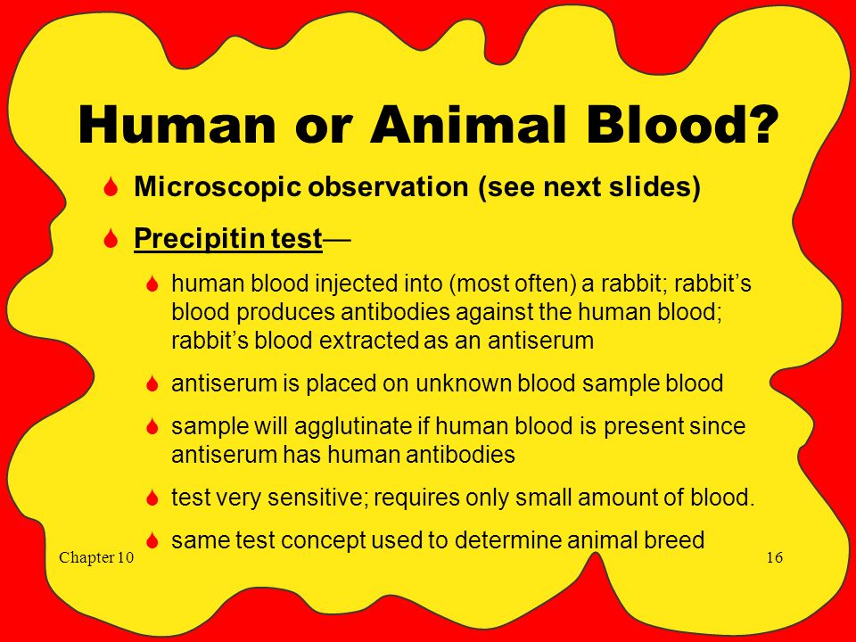 Chapter 10 Blood Identification & Serology “Out damned spot! Out, I say  Here's the smell of the blood still, All the perfumes of Arabia will not  Sweeten. - ppt download