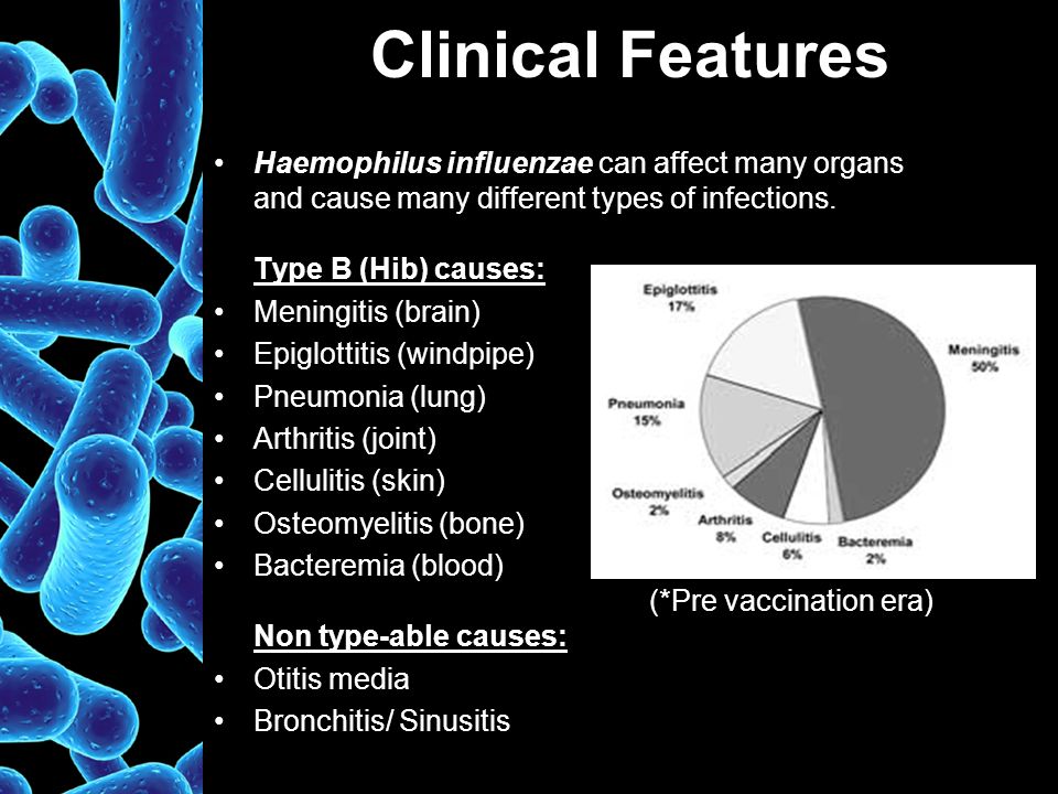 Haemophilus influenzae b. Гемофилия инфлюэнца микробиология. H. influenzae источник инфекции.