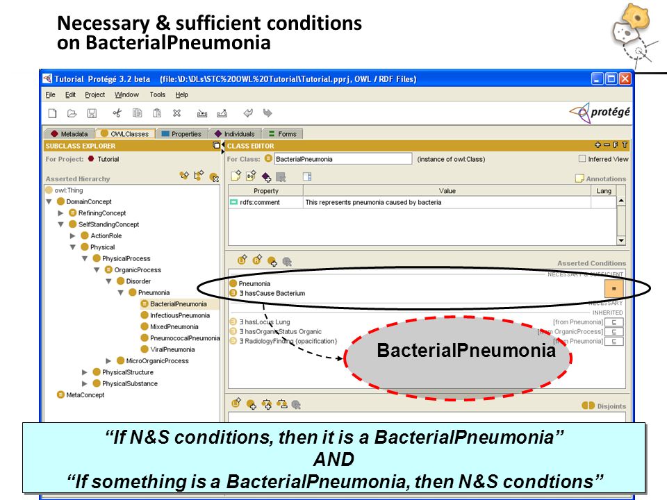 Necessary & sufficient conditions on BacterialPneumonia If N&S conditions, then it is a BacterialPneumonia AND If something is a BacterialPneumonia, then N&S condtions If N&S conditions, then it is a BacterialPneumonia AND If something is a BacterialPneumonia, then N&S condtions BacterialPneumonia