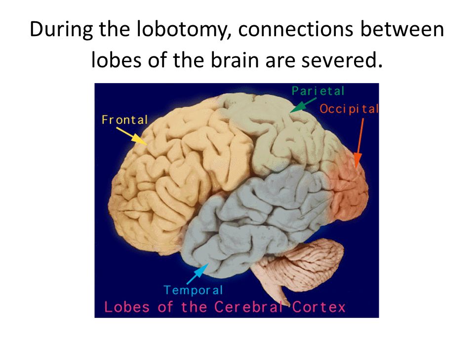 Brain 80. Lobes of the Brain. Insula Part of the Brain. Sulcuses Brain.