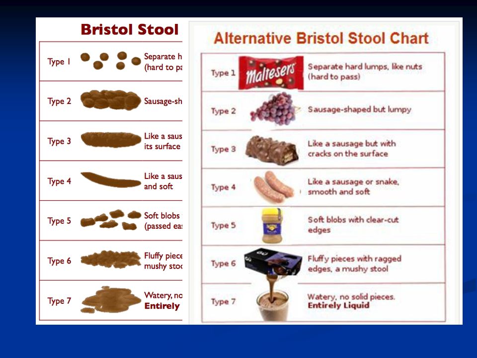 Alternative Bristol Stool Chart