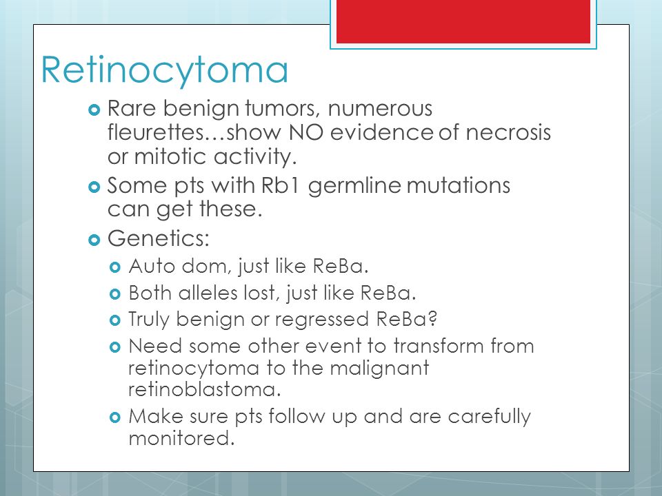 Sdl 22 Retinoblastoma Ct Retinoblastoma Retinoblastoma Definition And Epidemiology Def Malignant Tumor Of The Immature Retina Epidemiology Two Ppt Download