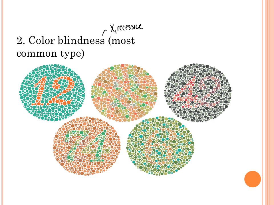 2. Color blindness (most common type)