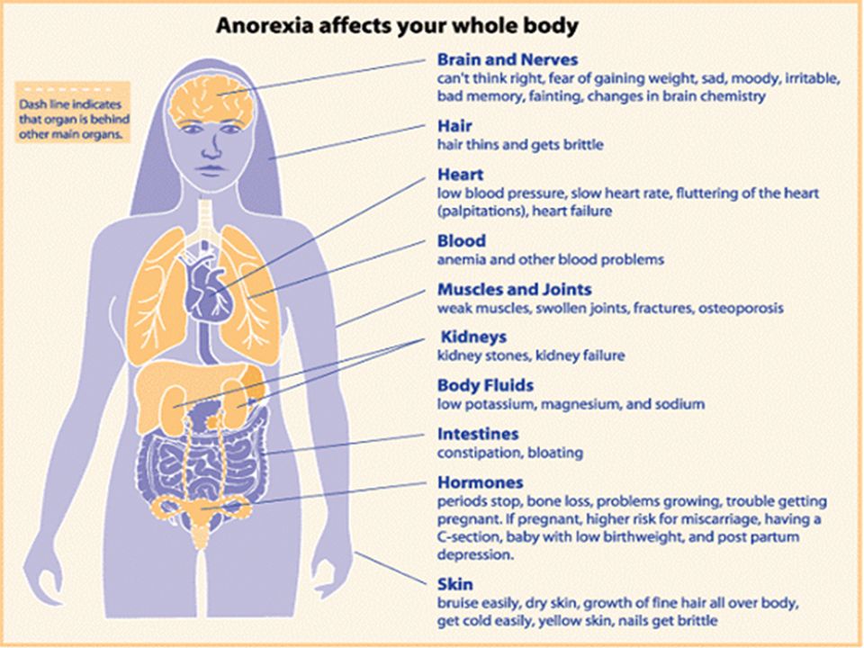 Anorexia significado emocional