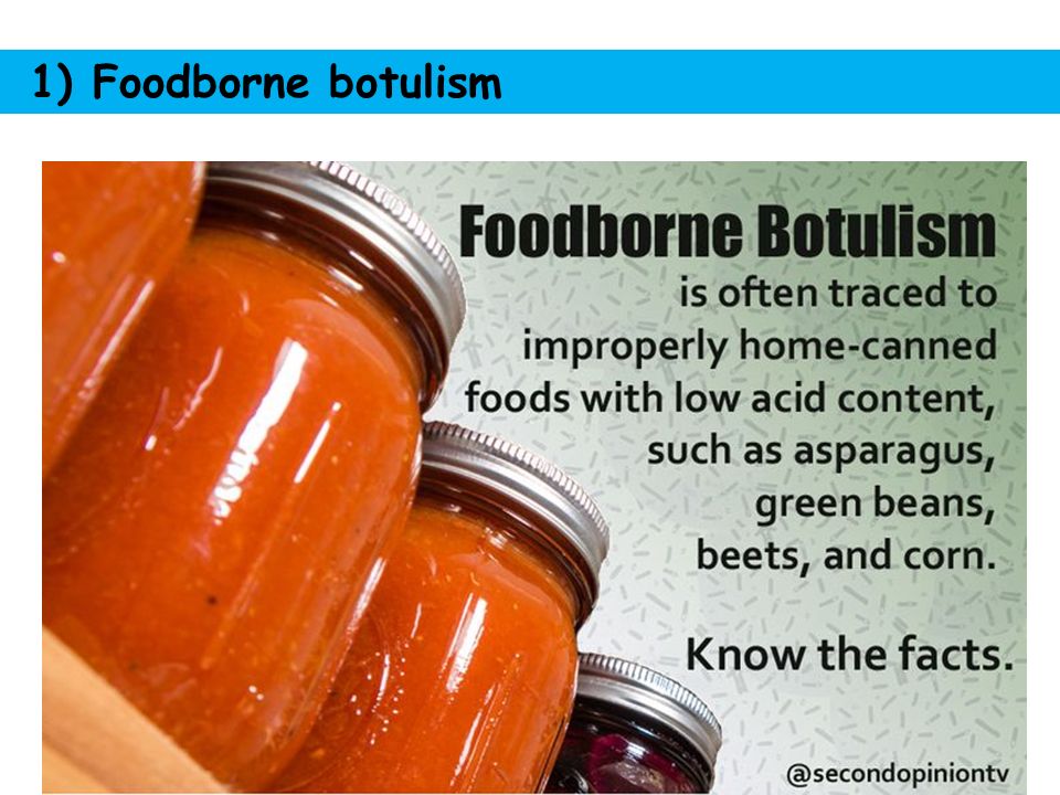 Холера ботулизм. Foodborne botulism:. Botulism treatment. Ботулизм тыква. Treatment botulism картина.