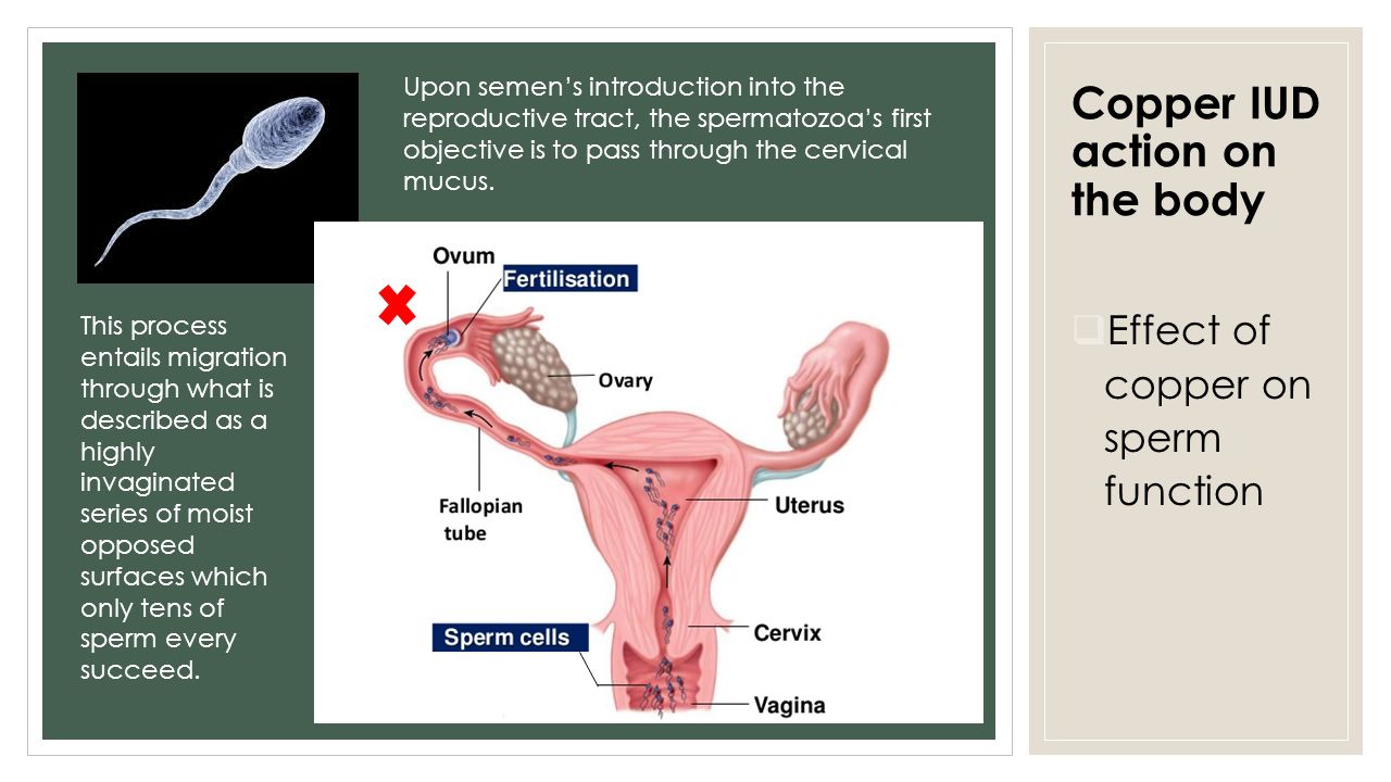 Effects of copper on sperm picture