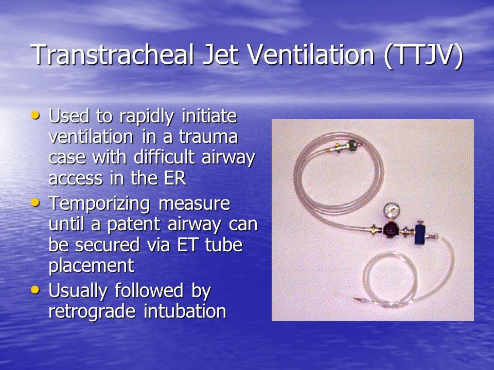 Emergency Airways Modification of Transtracheal Jet Ventilation and  Retrograde Intubation Techniques BME 272 Senior Design Group 20 Project  Undertaken. - ppt download