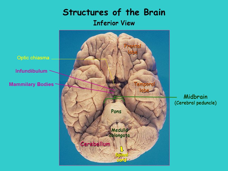 Week 10 Central Nervous System The Brain Sheep Humanhuman