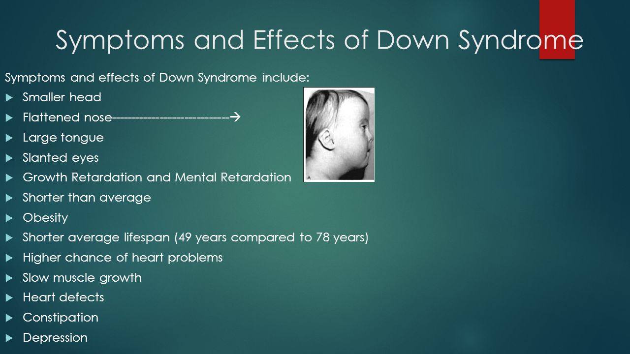 Down тема. Retardation. Down Syndrome incidence. Зеленый синдром группа.