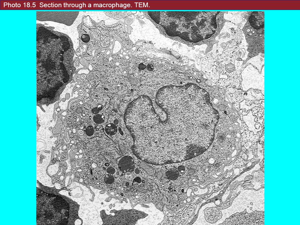 Photo 18.5 Section through a macrophage. TEM.
