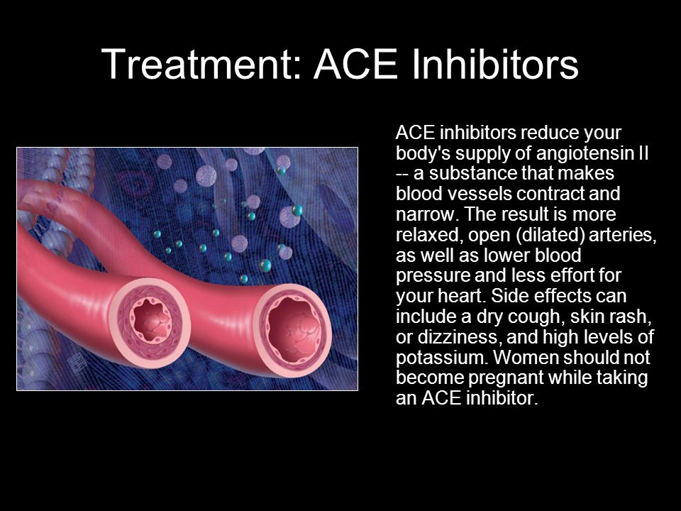Treatment: ACE Inhibitors ACE inhibitors reduce your body s supply of angiotensin II -- a substance that makes blood vessels contract and narrow.