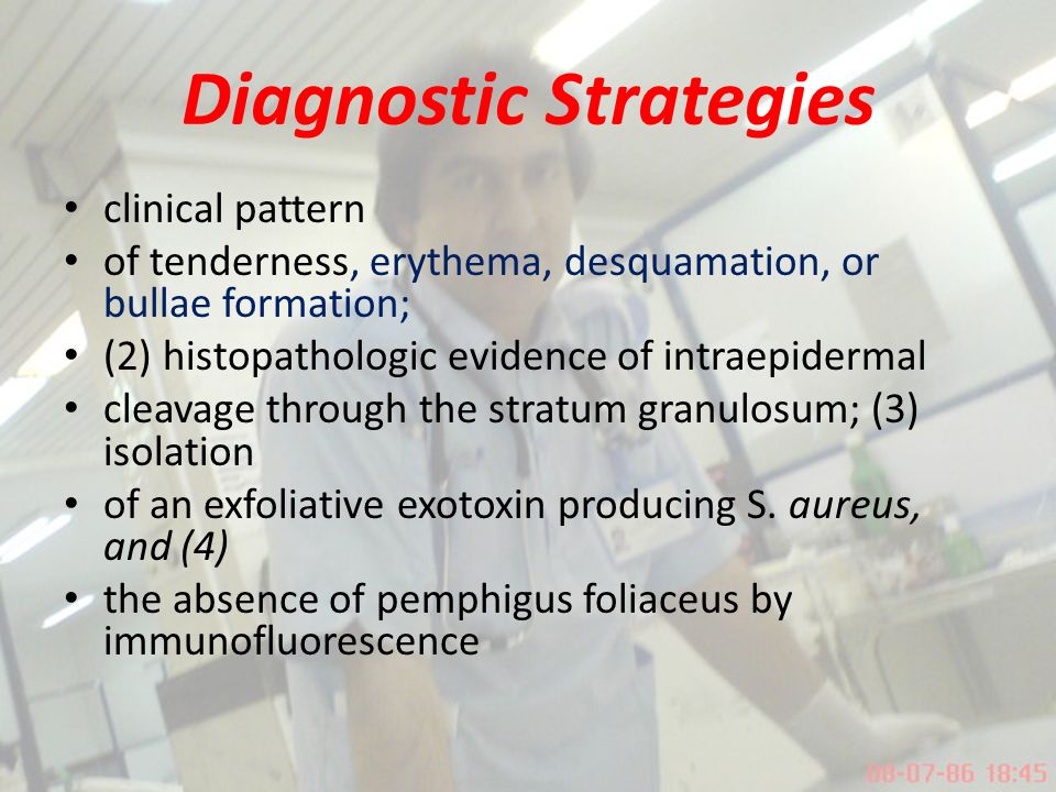 Diagnostic Strategies clinical pattern of tenderness, erythema, desquamation, or bullae formation; (2) histopathologic evidence of intraepidermal cleavage through the stratum granulosum; (3) isolation of an exfoliative exotoxin producing S.