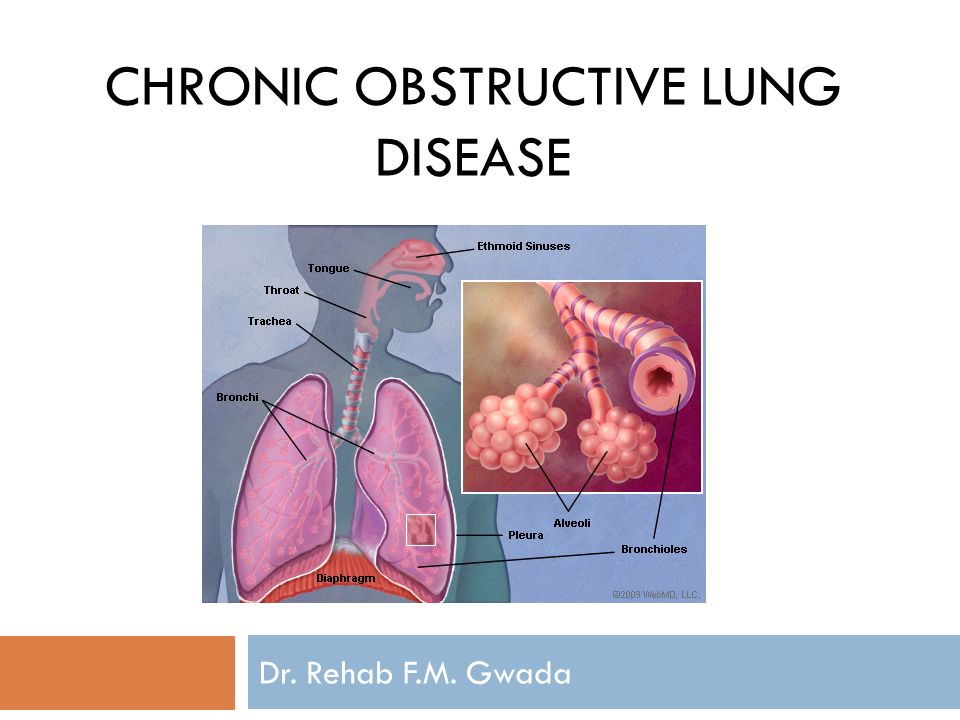 CHRONIC OBSTRUCTIVE LUNG DISEASE Dr. Rehab F.M. Gwada