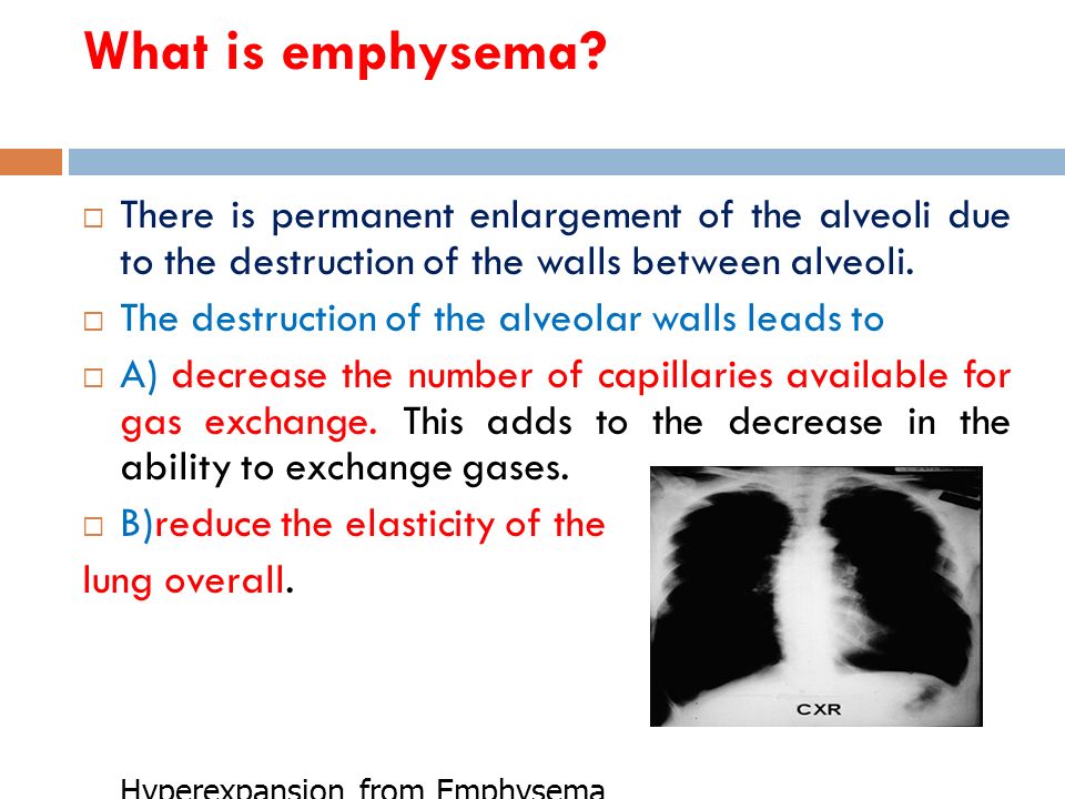 What is emphysema.