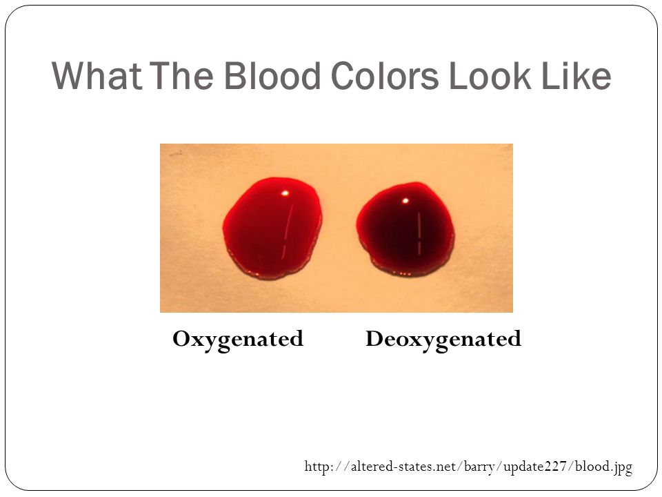 Почему кровь темная из вены. Цвет крови. Цвет человеческой крови.