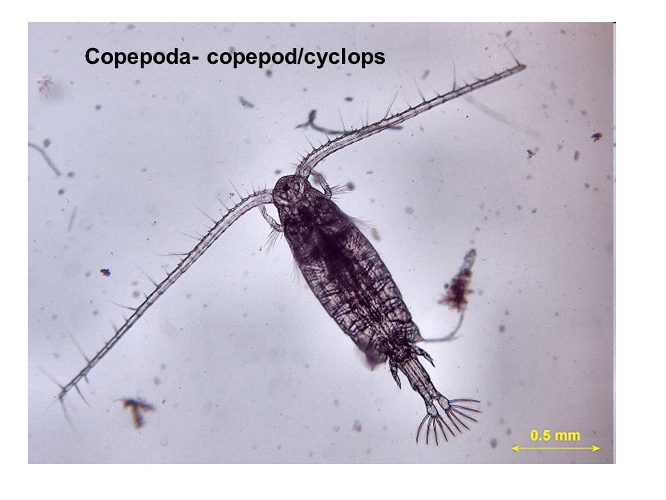 Циклоп краб. Отряд Copepoda – веслоногие. Циклоп зоопланктон. Copepoda диаптомус. Веслоногие ракообразные (Copepoda).