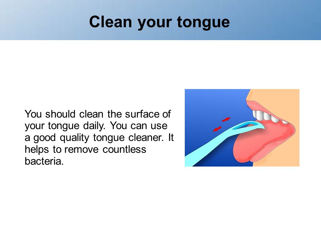 How to Take Care of Your Tongue Piercing picture How to Take Care of Your Tongue Piercing picture