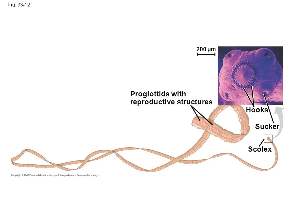 Fig Proglottids with reproductive structures Hooks Sucker Scolex 200 µm