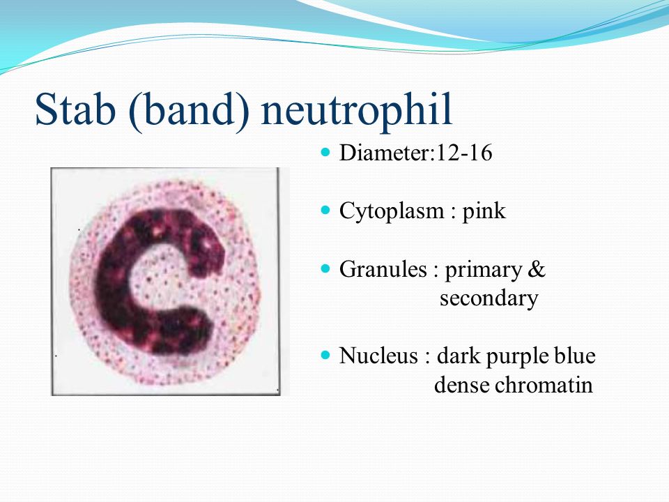 White Blood Cell Differential Count DR. Yasir M. Khaleel M.B.Ch.B, M.Sc. -  ppt download