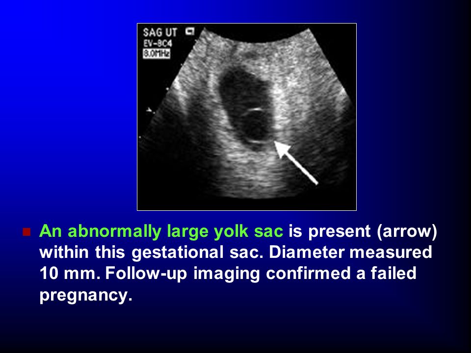 The embryonic phase of development is complete by the end of the 10th G.wk  embryonic phase. - ppt download