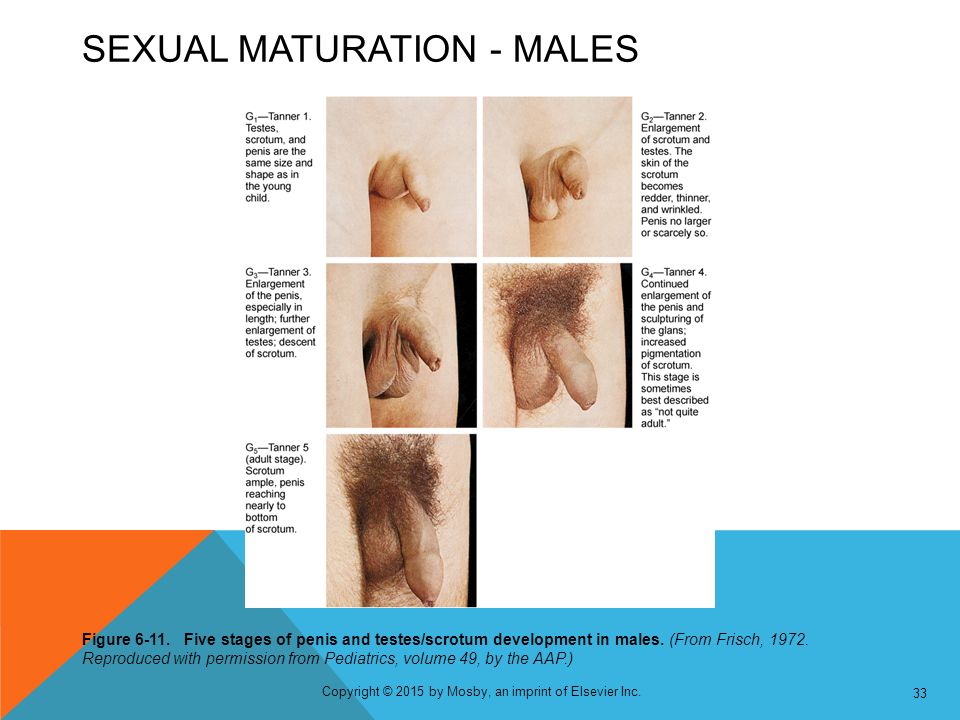 Five stages of penis and testes/scrotum development in males. 
