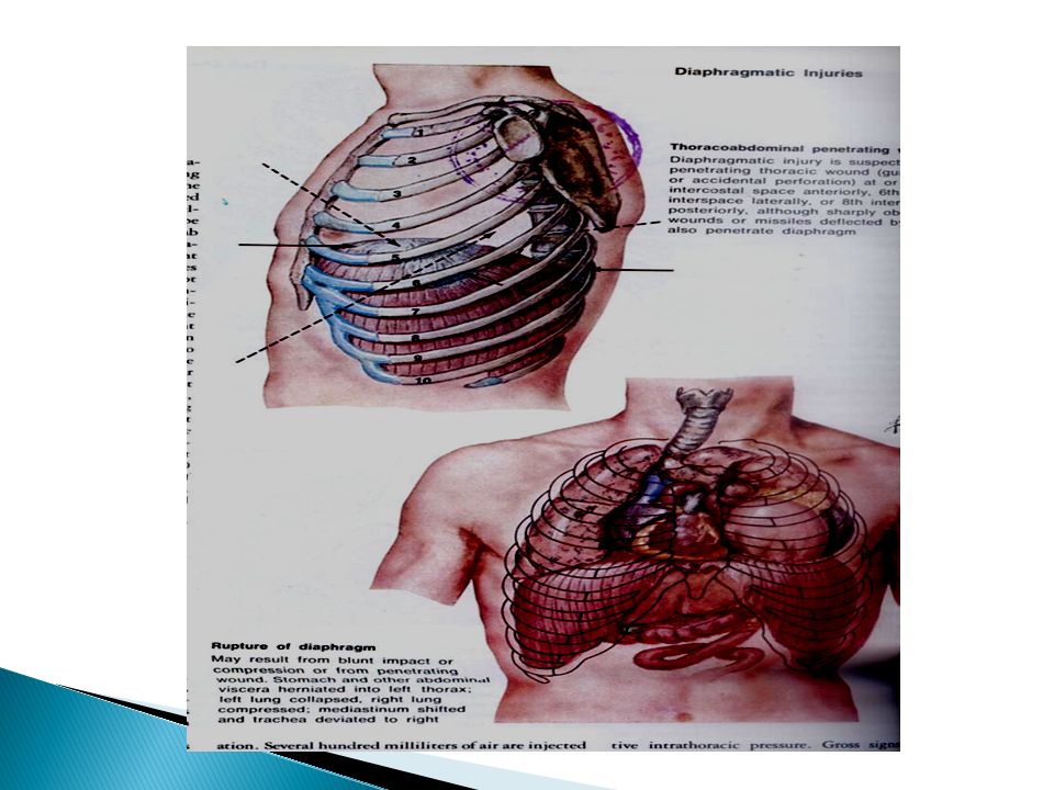 MedNote Collection  Indications of operative treatment in  THORACIC  INJURIES MedNote Collection   instagramcommednotecollection tmeMedNoteCollection  fbmeMedNoteCollection 